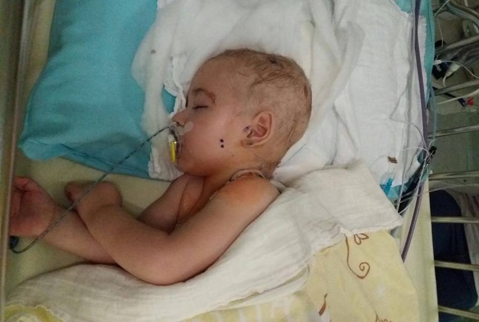 Małą Hanię czeka druga operacja