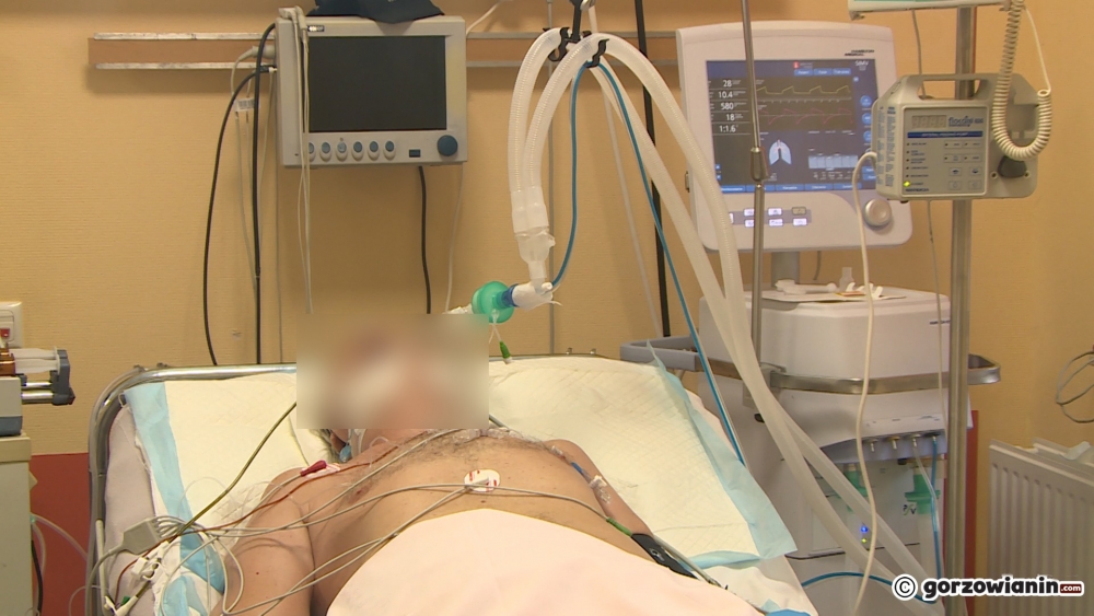 Prawie 800 zakażeń w regionie. Nie żyje 10 osób