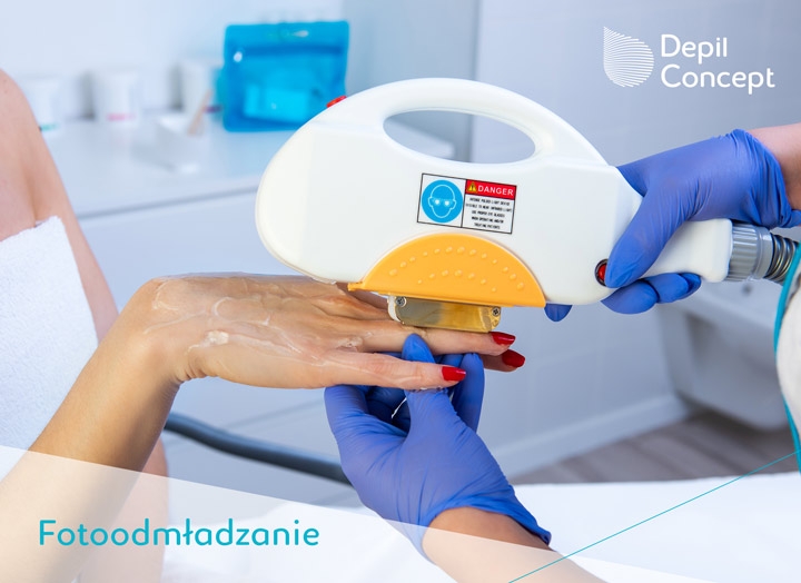 5/8 10 zalet trwałej depilacji SHR in motion!