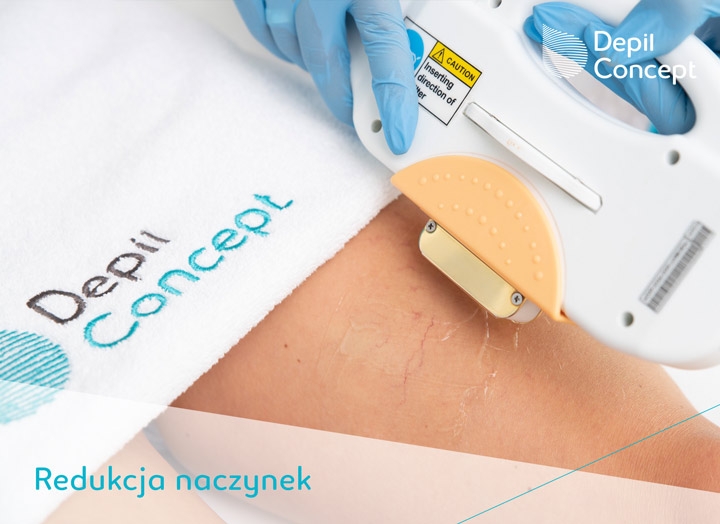 7/8 10 zalet trwałej depilacji SHR in motion!