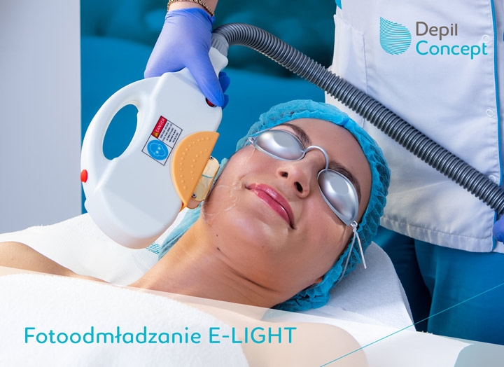 8/8 10 zalet trwałej depilacji SHR in motion!