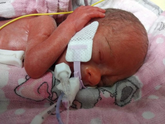 3/9 Mała Karinka to prawdziwy cud w gorzowskim szpitalu