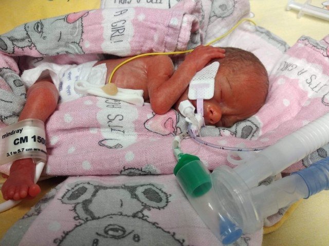 5/9 Mała Karinka to prawdziwy cud w gorzowskim szpitalu