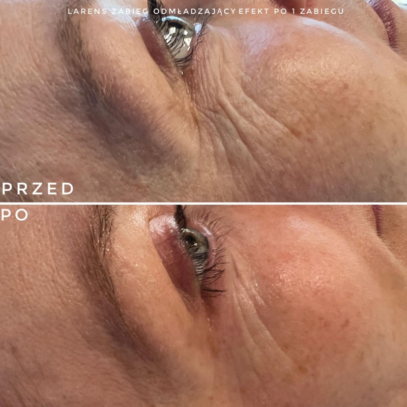 3/6 Perfect Look Clinic Gorzów Wlkp