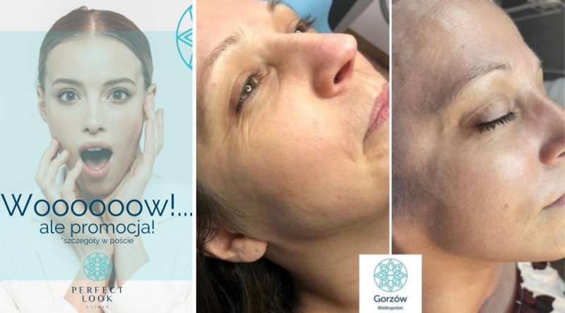 4/6 Perfect Look Clinic Gorzów Wlkp