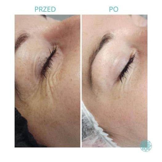 5/6 Perfect Look Clinic Gorzów Wlkp