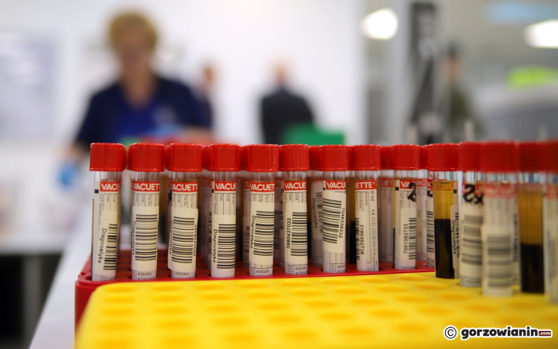 7/18 Nowe laboratorium Diagnostyki przy Targowej w Gorzowie już działa