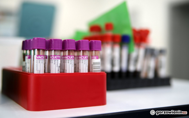 9/18 Nowe laboratorium Diagnostyki przy Targowej w Gorzowie już działa