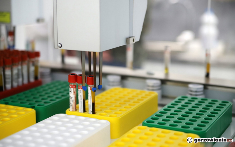 11/18 Nowe laboratorium Diagnostyki przy Targowej w Gorzowie już działa