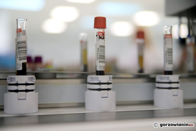13/18 Nowe laboratorium Diagnostyki przy Targowej w Gorzowie już działa