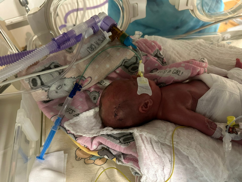 3/5 Łucja - od pierwszych chwil walczy o życie