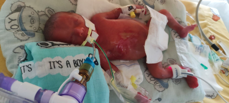 5/5 Łucja - od pierwszych chwil walczy o życie