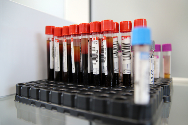 4/6 Borelioza szybciej w Gorzowie 